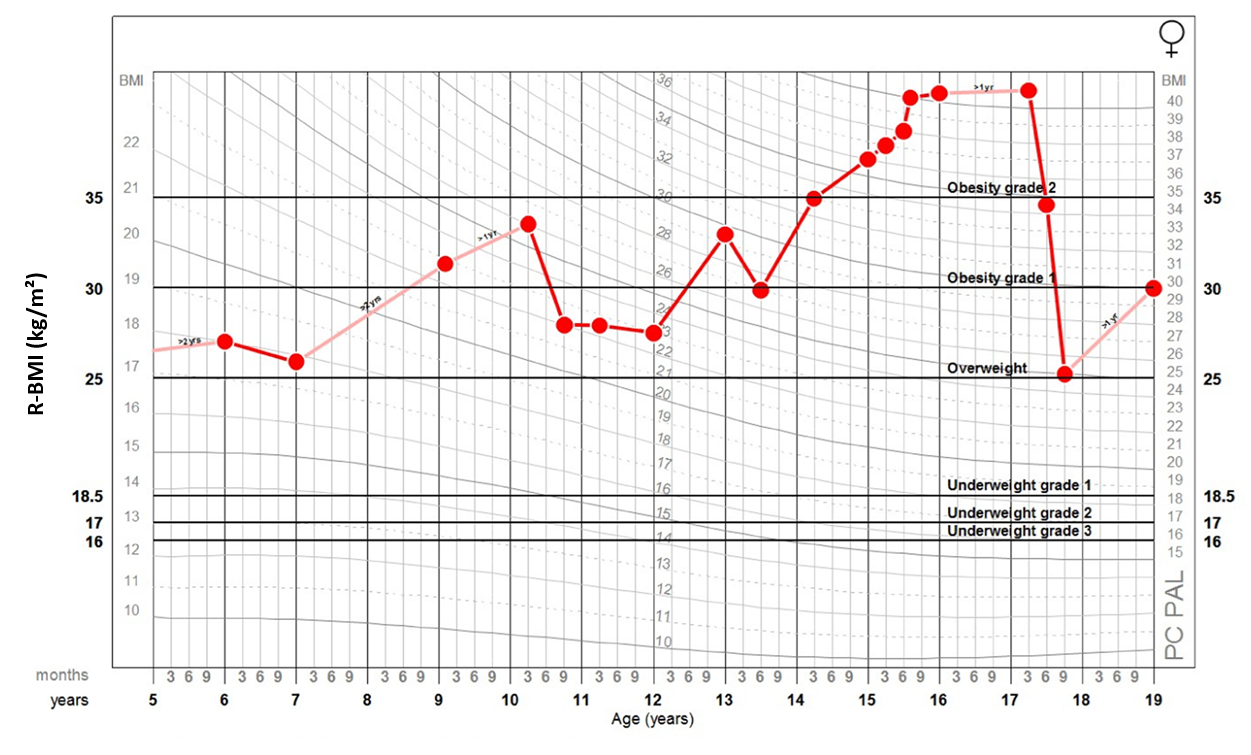 Horizontally designed R-BMI chart to depict body mass index for age groups 5 to 19.